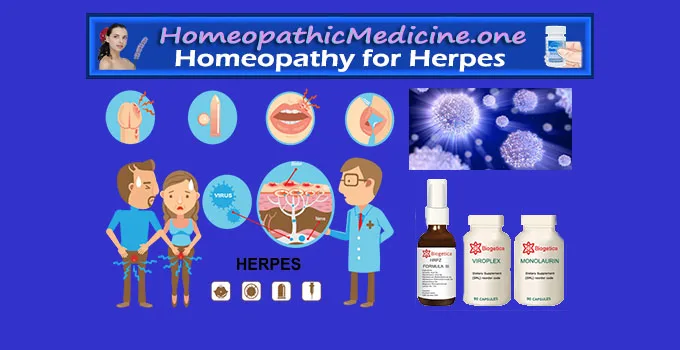 Homeopathy for Herpes Natural Remedies for Herpes
