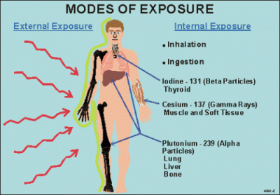 radiation exposure